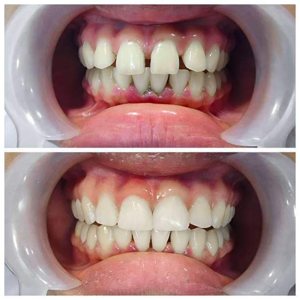 Best Full Mouth Reconstruction  in Fairland, MD